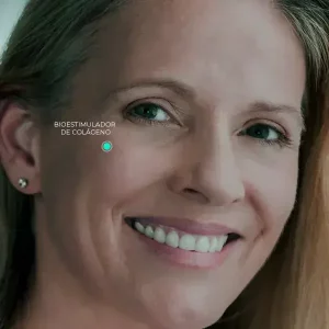 Bioestimulador de Colageno