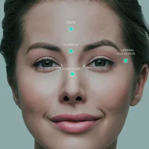 Botox 4 Regioes Peeling