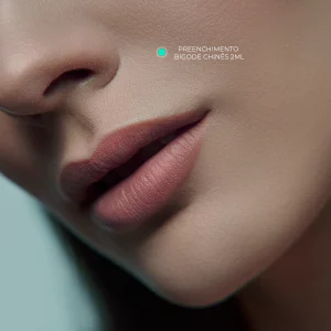 Preenchimento De Bigode Chines 2ml