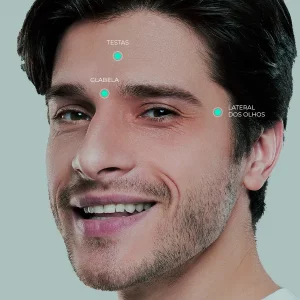 Toxina Botulinica 3 Regioes